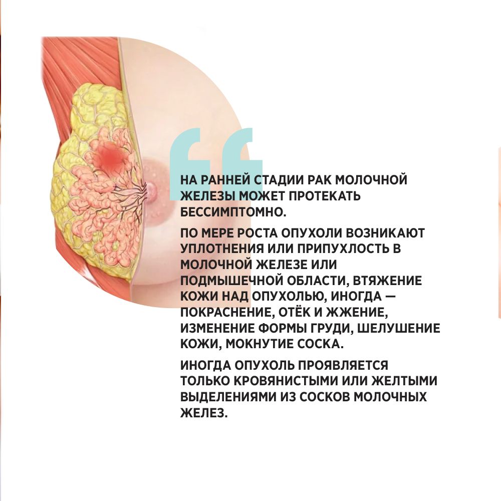 Операция при раке молочной железы в Москве